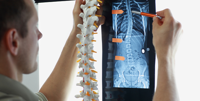 Cherry Hill Spinal Cord Injury Lawyer Cherry Hill Spinal Cord Injury Lawyer